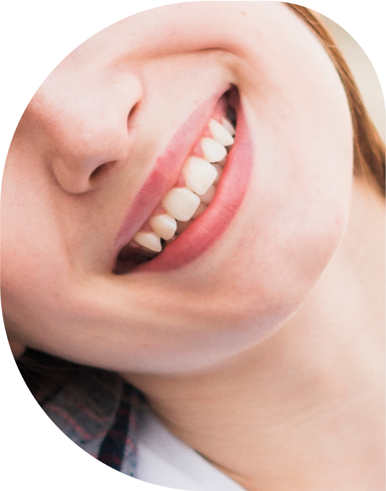 Dentol Smile Studio sonrisa