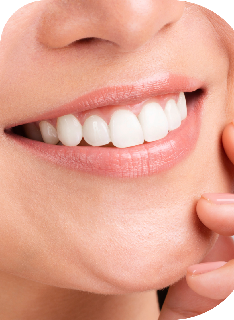 Dentol Smile Studio sonrisa